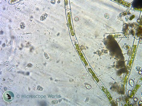  Yankovicella! Một Protist Kỳ Lạ Có Bên Trong Nó Là Bầu Trời Siêu Vi Mô